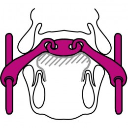 Sprenger KK Ultra double jointed bradoon loose ring 12mm sensogan