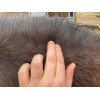 Animaderm Derfen Clear